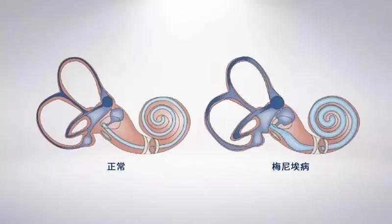 重庆治疗眩晕医院
