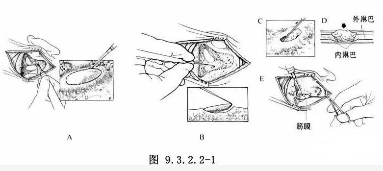 耳石症