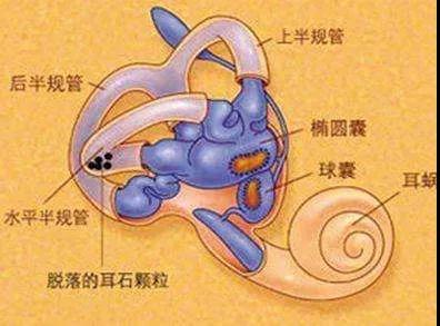 耳石症复位