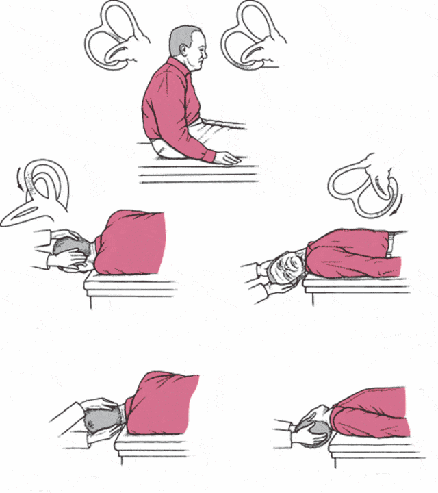 重庆眩晕医院